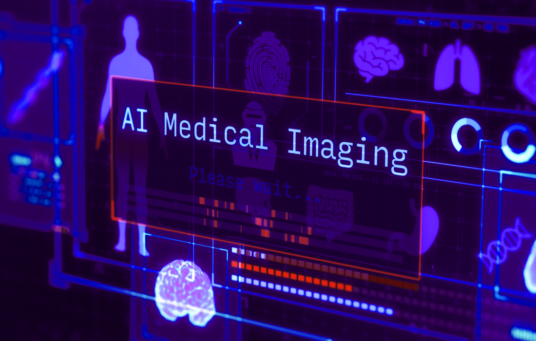 精度と速さを両立できない